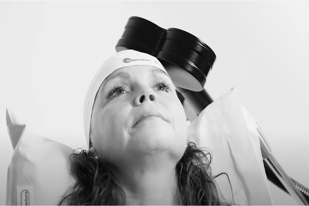 Neinvazinė neuromoduliacija - transkranijinė magnetinė stimuliacija rTMS