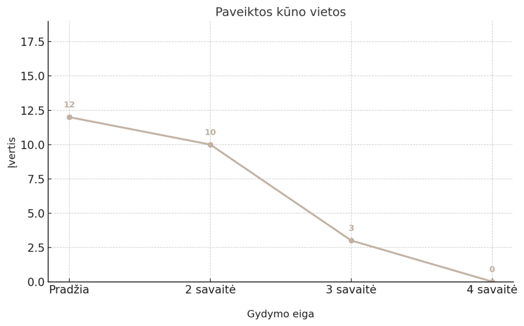 Fibromialgija 4 Fibromialgija